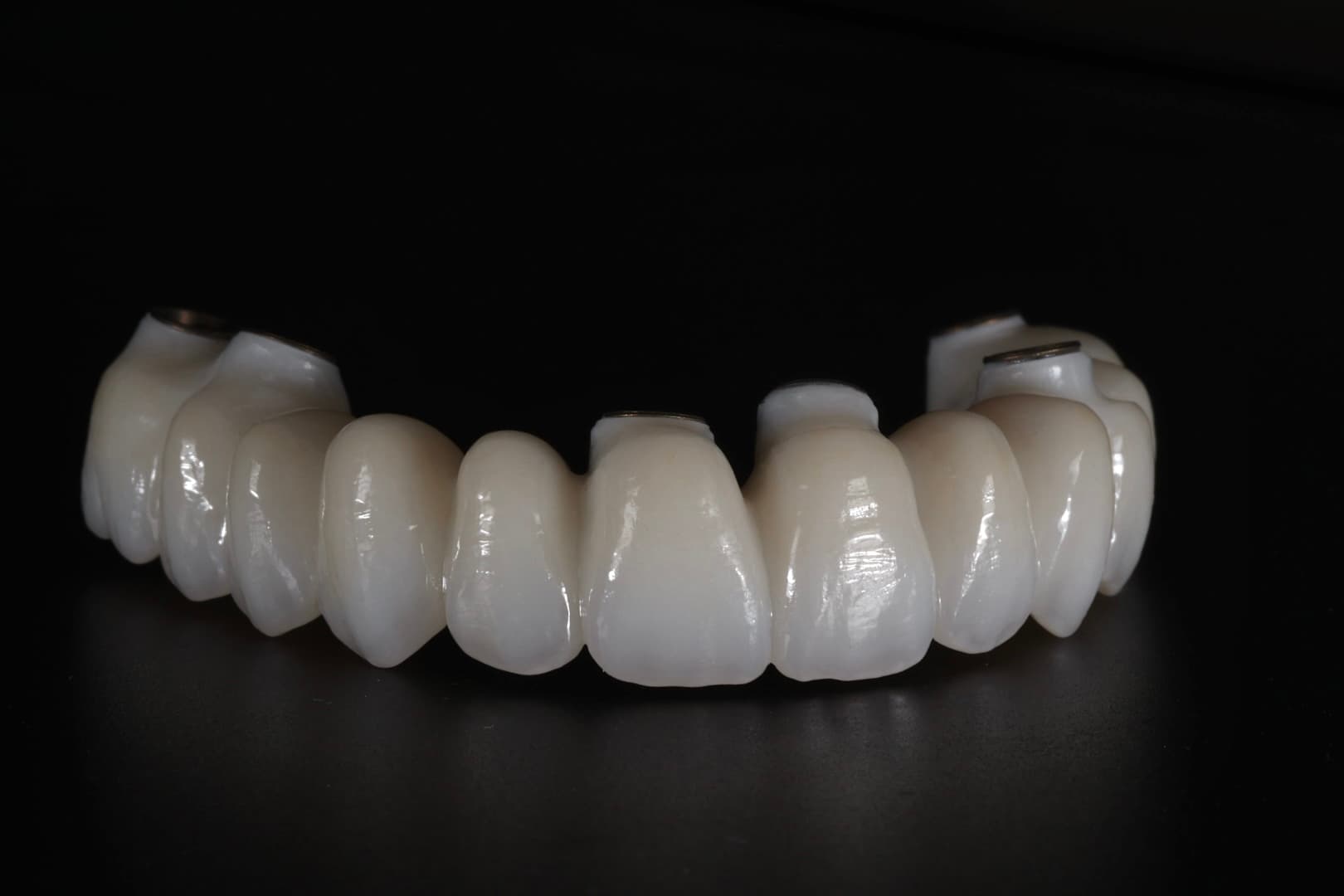 Dental Implant 5