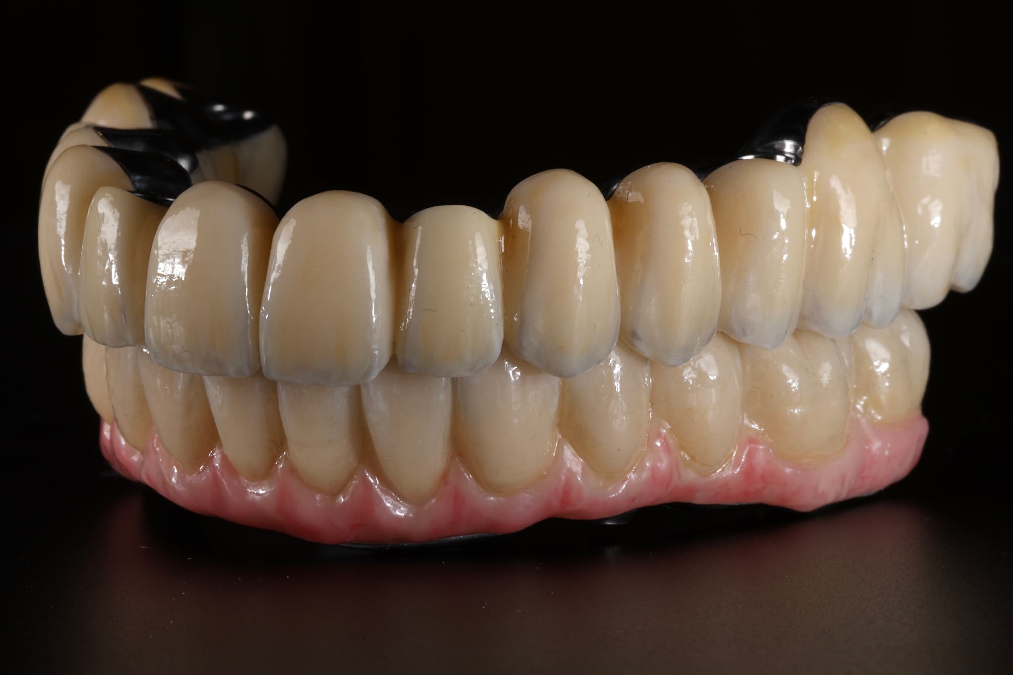 Dental Implant 13
